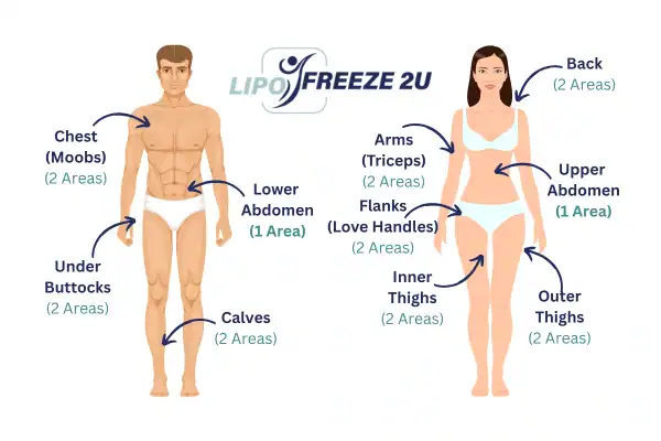 Areas you can have fat freezing treatment Birmingham