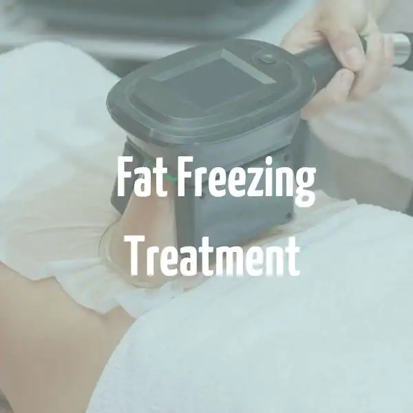 fat freezing treatment Birmingham