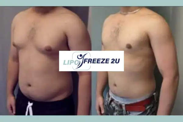 How Long Does It Take to See Results Birmingham?