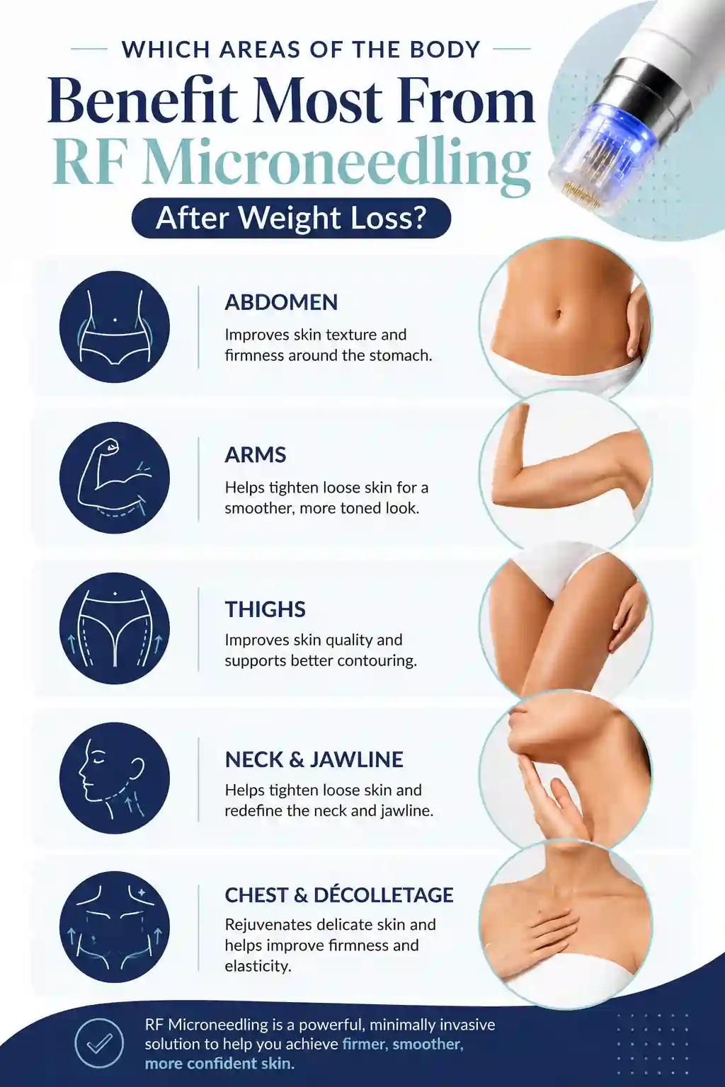 Which Areas of the Body Benefit Most From RF Microneedling After Weight Loss Birmingham